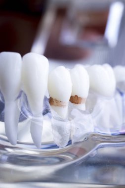 Diş hekimi diş diş modeli gösteren öğretim her diş ve dişeti hastalar ve öğrenciler için.