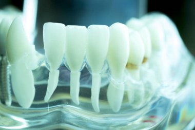 Diş hekimi diş diş modeli gösteren öğretim her diş ve dişeti hastalar ve öğrenciler için.