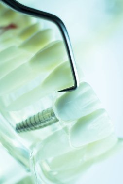 Titanyum metal diş hekimi temizlik dişler plak ve çürüme kaldırmak için araç almak.