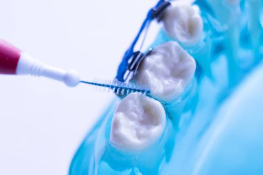 Diş diş fırçası sağlıklı ipi eylem her diş diş teli aligners ile arasında temizlik Inter.