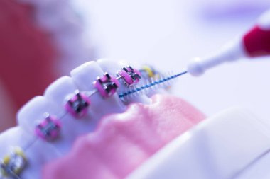 Diş diş fırçası sağlıklı ipi eylem her diş diş teli aligners ile arasında temizlik Inter.