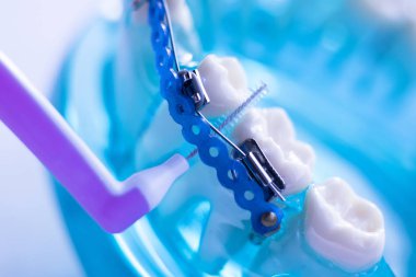 Diş diş fırçası sağlıklı ipi eylem her diş diş teli aligners ile arasında temizlik Inter.