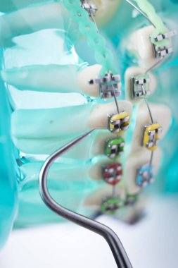 Diş metal diş teli Ortodonti modeli öğretim diş telini aligners.