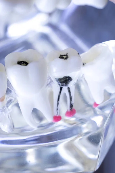 Modèle Enseignement Dentaire Dentiste Montrant Chaque Dent Gencive Pour Les — Photo