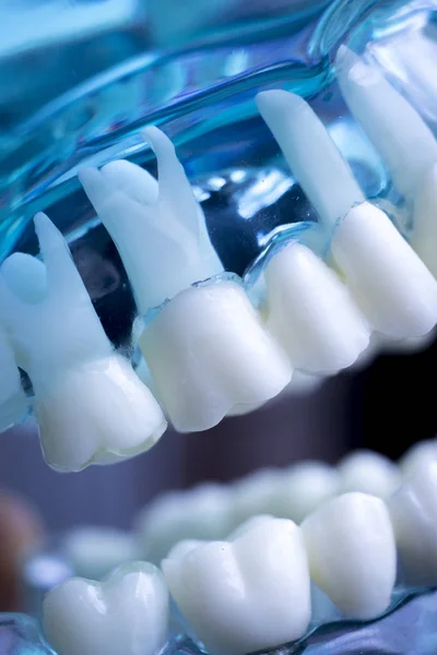 Dentista Modelo Ensino Dentes Dentários Mostrando Cada Dente Goma Para — Fotografia de Stock