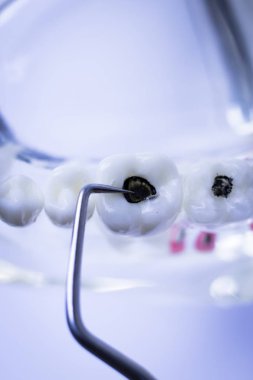 Titanyum metal diş hekimi temizlik dişler plak ve çürüme kaldırmak için araç almak.