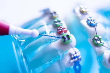 Diş diş fırçası sağlıklı ipi eylem her diş diş teli aligners ile arasında temizlik Inter.