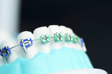 Diş metal diş teli Ortodonti modeli öğretim diş telini aligners.