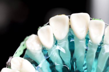 Diş metal diş teli Ortodonti modeli öğretim diş telini aligners.