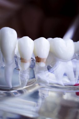 Diş hekimi diş diş modeli gösteren öğretim her diş ve dişeti hastalar ve öğrenciler için.