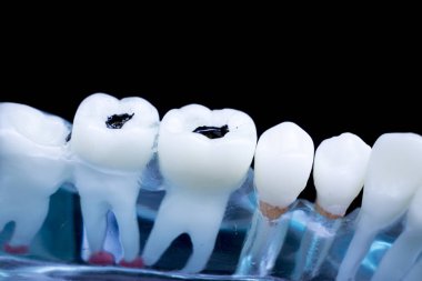 Diş hekimi diş diş modeli gösteren öğretim her diş ve dişeti hastalar ve öğrenciler için.