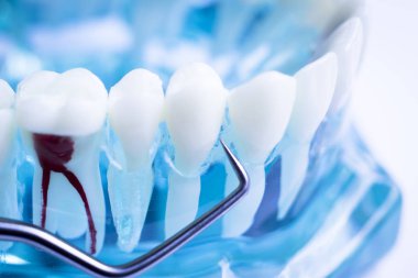 Titanyum metal diş hekimi temizlik dişler plak ve çürüme kaldırmak için araç almak.