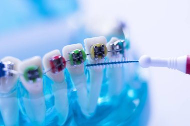 Diş diş fırçası sağlıklı ipi eylem her diş diş teli aligners ile arasında temizlik Inter.