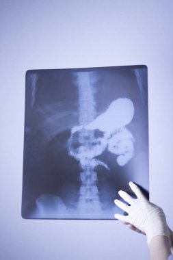 Tıbbi hastane röntgen lowe geri ağrı da mide ve organları gösteren omurga ve kalça Travmatoloji tarama.