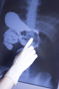 Tıbbi hastane röntgen lowe geri ağrı da mide ve organları gösteren omurga ve kalça Travmatoloji tarama.