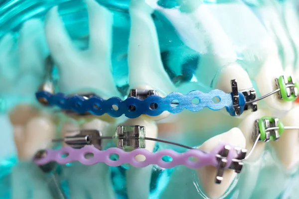 Diş metal diş teli Ortodonti modeli öğretim diş telini aligners.