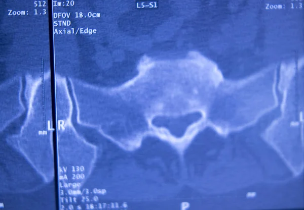 Medical Hospital Ray Hips Spine Pelvis Mri Traumatology Scan — Stock Photo, Image