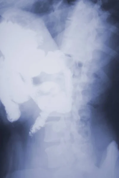 Рентген Позвоночника Травматологическое Сканирование Бёдер Показало Желудок Органы — стоковое фото