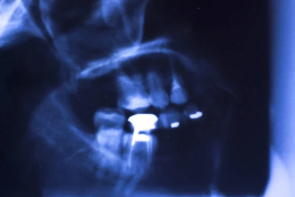 Hôpital Médical Radiographie Visage Crâne Bouche Dents Nez Yeux Scan — Photo