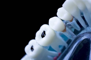 Diş hekimi diş diş modeli gösteren öğretim her diş ve dişeti hastalar ve öğrenciler için.