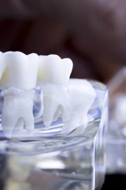 Diş hekimi diş diş modeli gösteren öğretim her diş ve dişeti hastalar ve öğrenciler için.