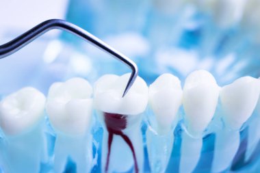 Titanyum metal diş hekimi temizlik dişler plak ve çürüme kaldırmak için araç almak.