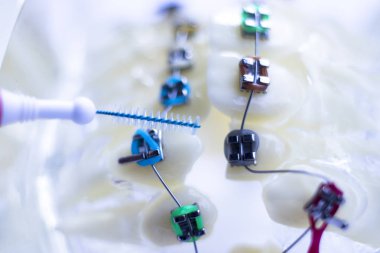 Diş diş fırçası sağlıklı ipi eylem her diş diş teli aligners ile arasında temizlik Inter.