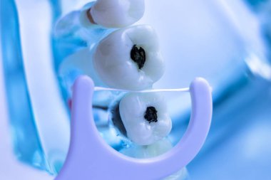 Diş diş fırça sağlıklı ipi eylem arasında plak kaldırmak için her diş temizleme Inter.