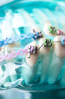 Diş metal diş teli Ortodonti modeli öğretim diş telini aligners.