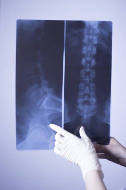 Tıbbi hastane röntgen lowe sırt ağrısı omurga ve kalça Travmatoloji tarama.