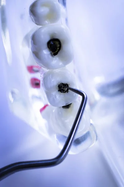 Dentista Limpieza Dientes Con Instrumento Selección Dientes Metal Titanio Para — Foto de Stock