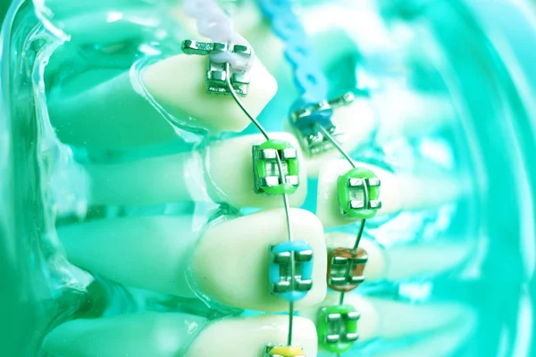 Diş metal diş teli Ortodonti modeli öğretim diş telini aligners.