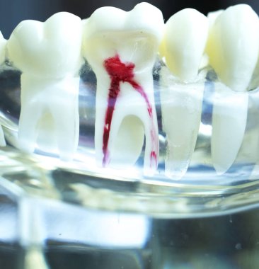 Diş hekimi diş diş modeli gösteren öğretim her diş ve dişeti hastalar ve öğrenciler için.