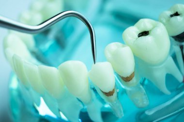 Titanyum metal diş hekimi temizlik dişler plak ve çürüme kaldırmak için araç almak.