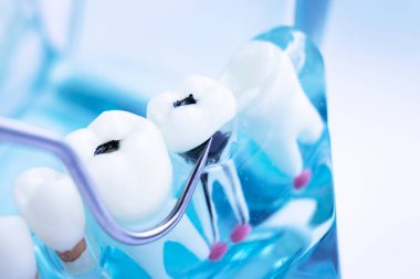 Titanyum metal diş hekimi temizlik dişler plak ve çürüme kaldırmak için araç almak.