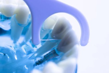 Diş diş fırça sağlıklı ipi eylem arasında plak kaldırmak için her diş temizleme Inter.