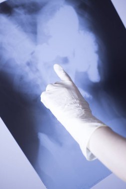 Tıbbi hastane röntgen lowe geri ağrı da mide ve organları gösteren omurga ve kalça Travmatoloji tarama.