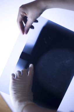 Tıbbi hastane mamografi x-ray meme kanseri mamografi inceden inceye gözden geçirmek.