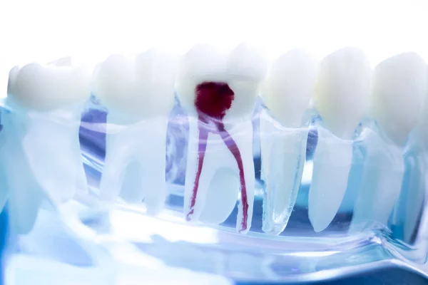 Denti Dentisti Modello Insegnamento Che Mostra Ogni Dente Gomma Pazienti — Foto Stock