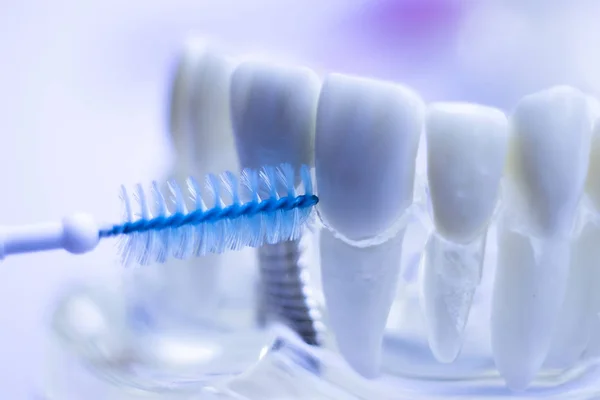 牙间刷牙清洁刷健康牙线之间的每颗牙齿消除斑块 — 图库照片