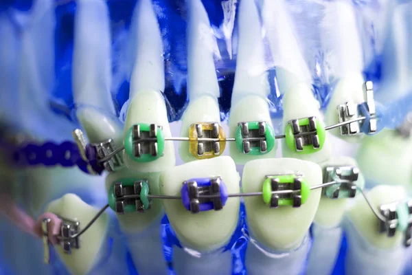 Diş metal diş teli Ortodonti modeli öğretim diş telini aligners.
