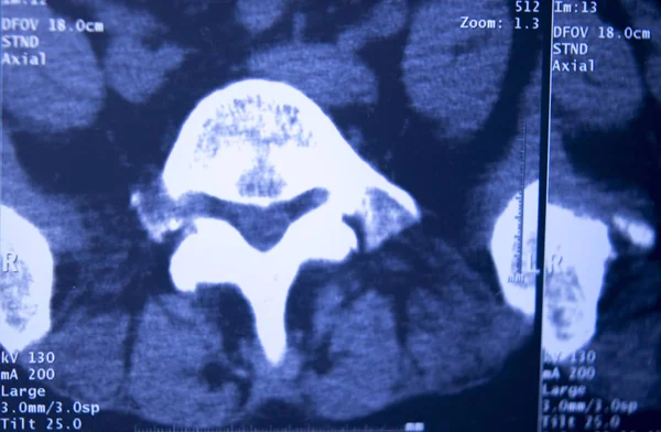 Radiografía Hospital Médico Caderas Columna Pelvis Resonancia Magnética Traumatología — Foto de Stock
