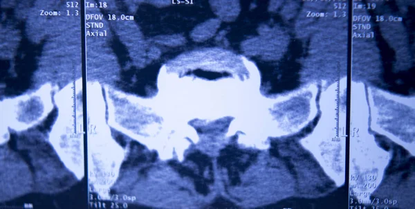 Medical Hospital Ray Hips Spine Pelvis Mri Traumatology Scan — Stock Photo, Image