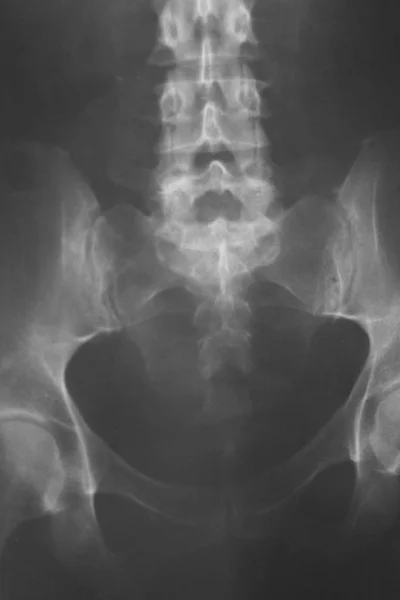 医疗医院 线背痛脊柱和髋部创伤扫描 — 图库照片