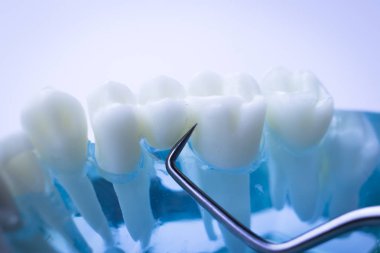 Titanyum metal diş hekimi temizlik dişler plak ve çürüme kaldırmak için araç almak.