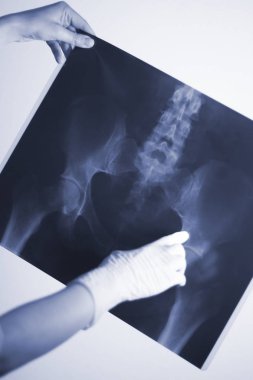 Tıbbi hastane röntgen lowe sırt ağrısı omurga ve kalça Travmatoloji tarama.