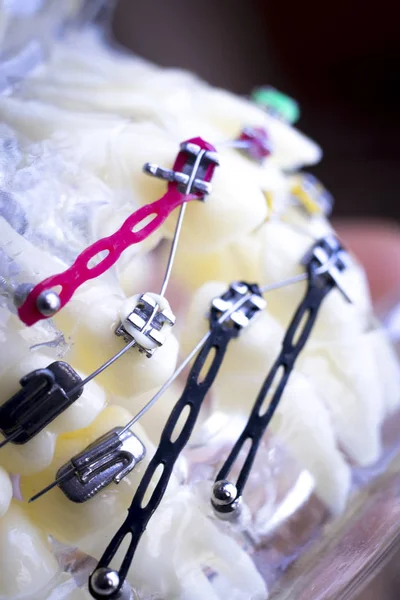 Diş metal diş teli Ortodonti modeli öğretim diş telini aligners.