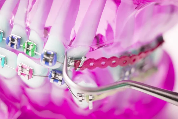 Diş metal diş teli Ortodonti modeli öğretim diş telini aligners.