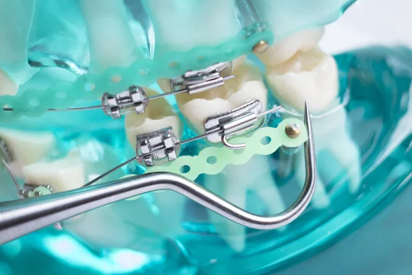 Diş metal diş teli Ortodonti modeli öğretim diş telini aligners.