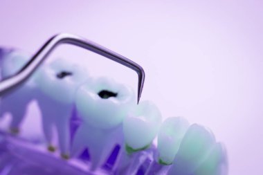 Titanyum metal diş hekimi temizlik dişler plak ve çürüme kaldırmak için araç almak.